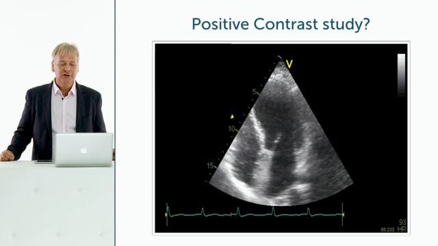 Negative or positive contrast study? A patient with intrapulmonary shunt