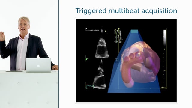 What is Triggered Multibeat Acquisition?