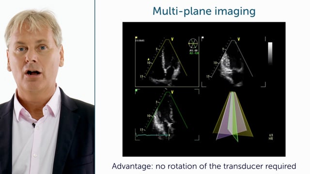 What is multi-plane imaging?