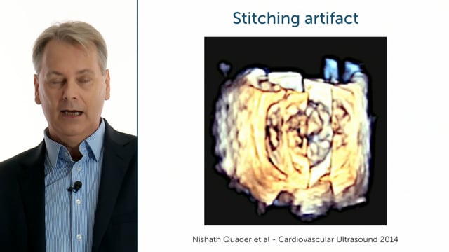 What are pitfalls & problems when using 3D echocardiography?