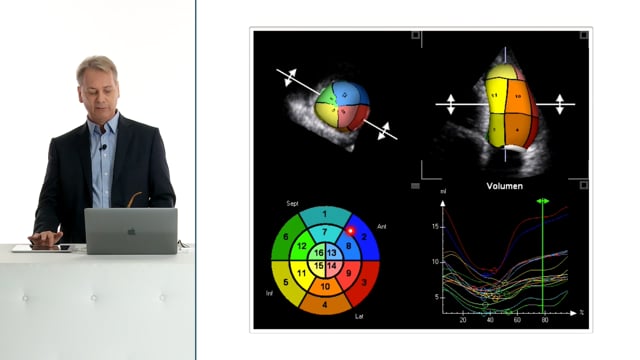 How can I use 3D echocardiography to quantify volumes and functions?