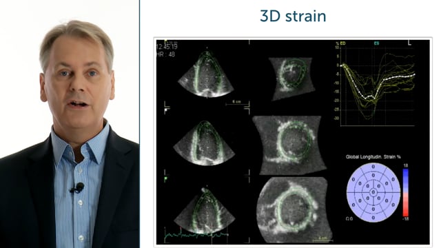 How can functional information be displayed in 3D echocardiography?