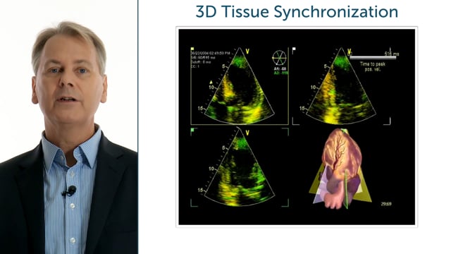 How can I evaluate dyssynchrony in 3D echocardiography?