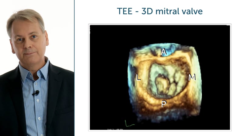 What is the surgical view of the Mitral valve?