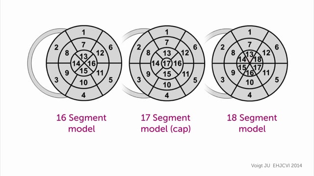 How can I evaluate the bullseye display?