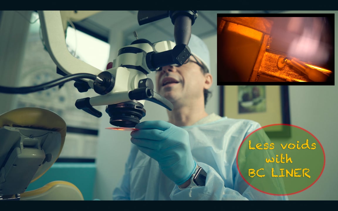 Eliminating Voids in BC Liner BulkFills (Friday Questions) Real