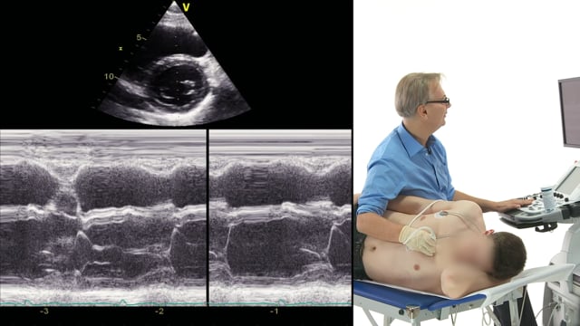 How do I use M mode during an echocardiography exam?