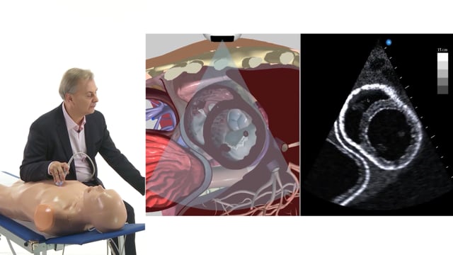 What is the parasternal short-axis view?