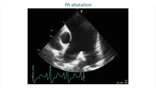 What kinds of pathology can I see in the parasternal short-axis view?