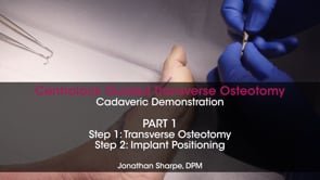 Part 1 – Centrolock® Cadaveric Demonstration