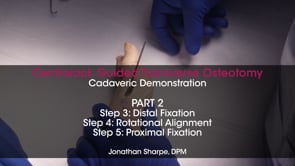 Part 2 – Centrolock® Cadaveric Demonstration