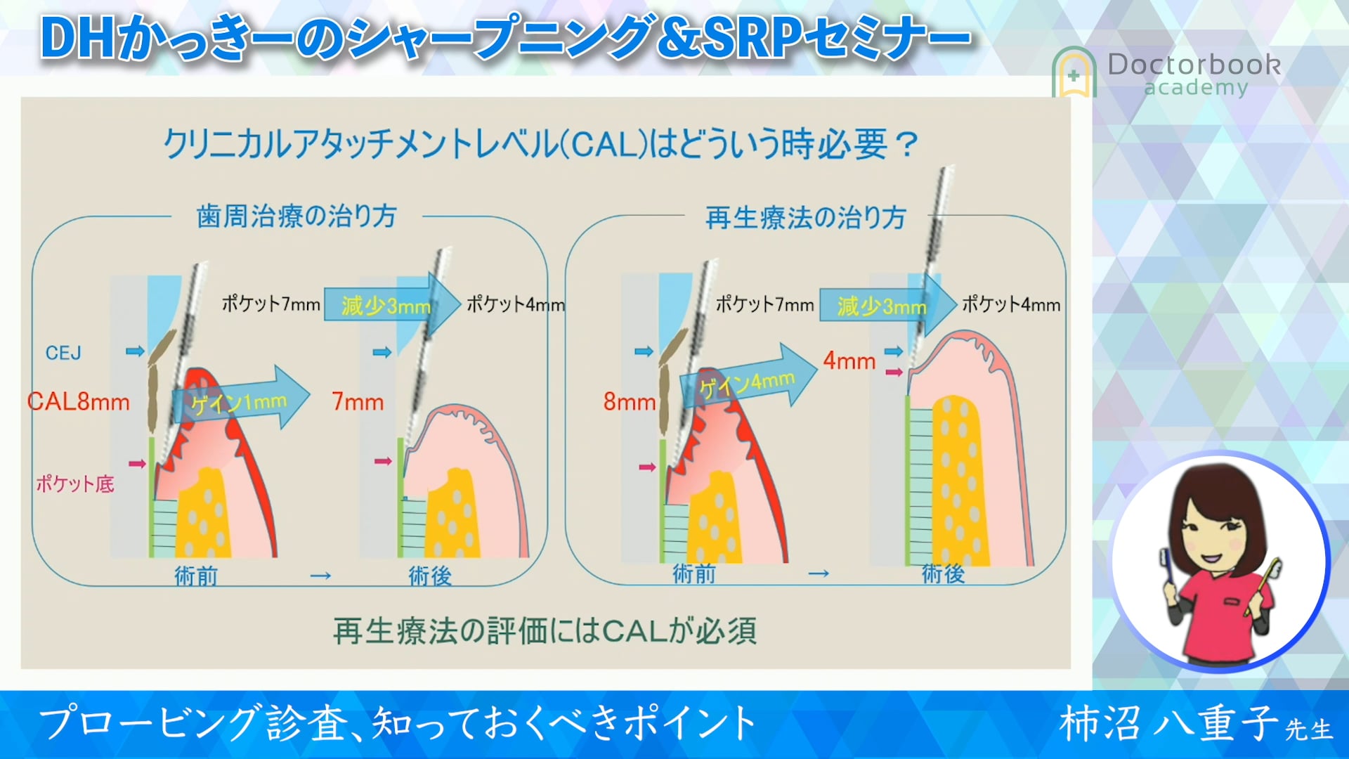 プロービング診査、知っておくべきポイント #2