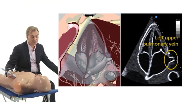 What are the anatomical landmarks for the apical 4 chamber view?