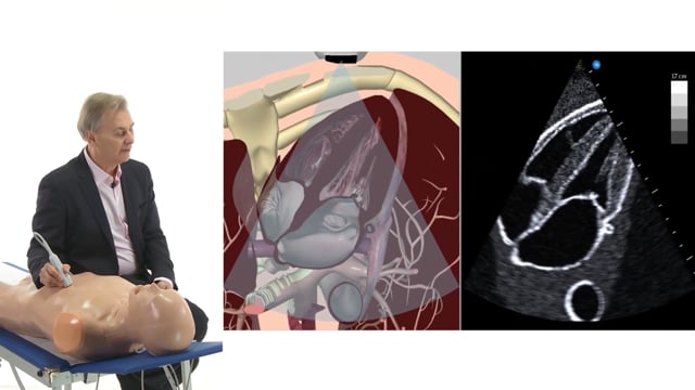 What is the biggest mistake when imaging from the apical window?