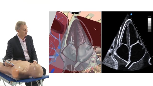 Why is rotation important for the apical 4-chamber view?