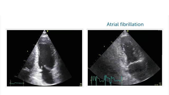 What pathologies can be imaged using the apical long-axis view?