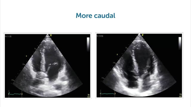 What are the key points to keep in mind with regards to the apical window?