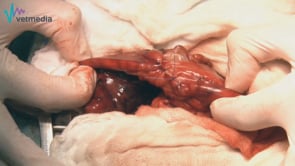 Piloroplastia de avance en Y-U