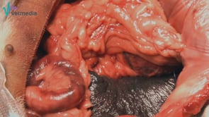 Colocación de sonda de gastrostomía