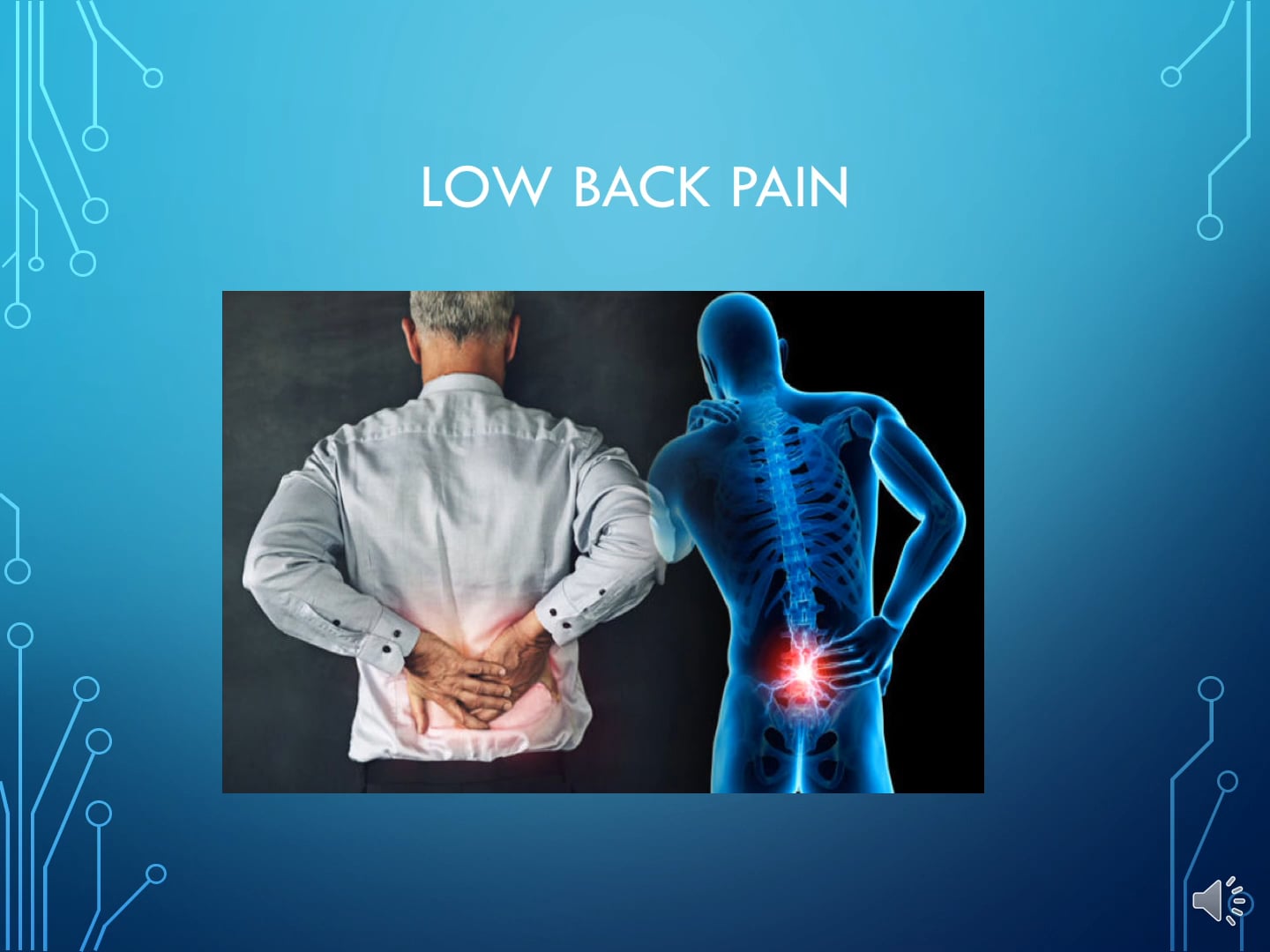 Low Back Pain – Central Island Pain Program