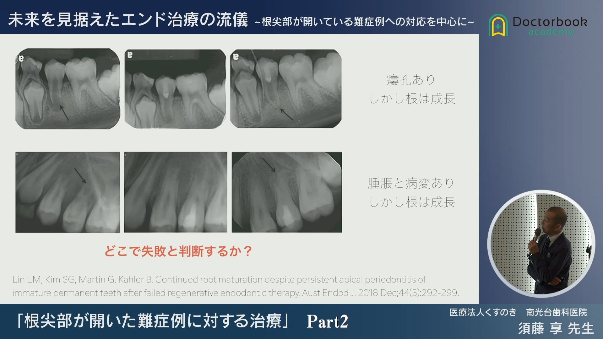 #2 リジェネの成功率と失敗症例