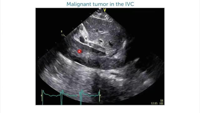 What pathologies can you see in these IVC images?