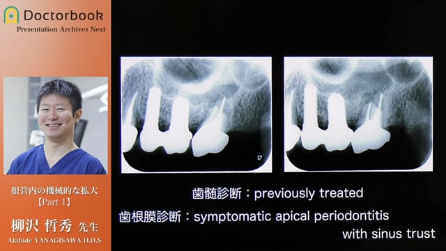 マイクロだから診れる、治せる歯内療法