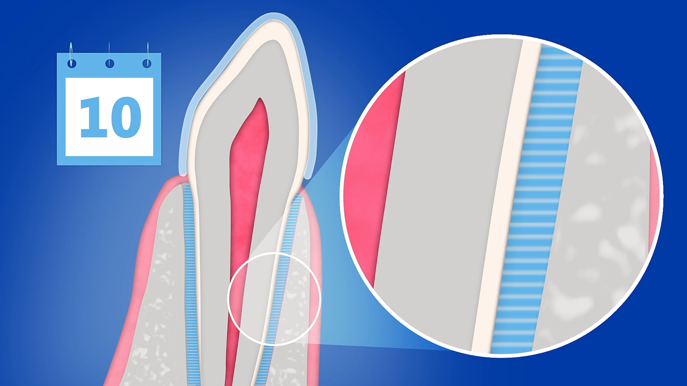 Orthosnap - How Clear Aligners Work | Videos & Movies on Vimeo