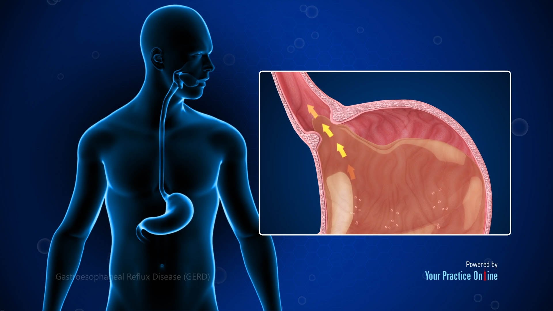 876017741-c760575533e898164562c41d1d13ad