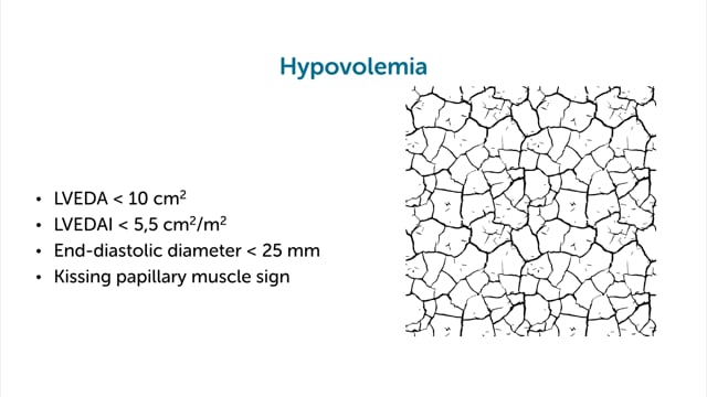 Can I use the LV end-diastolic area to assess fluid status?