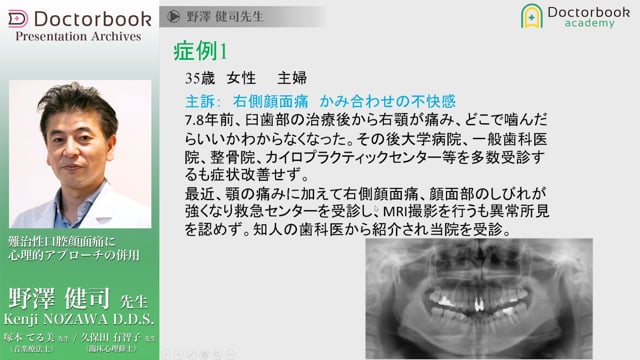 難治性口腔顔面痛に心理的アプローチの併用