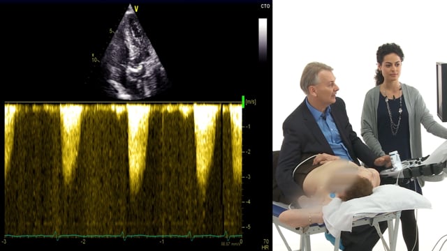 How do I get a good signal for assessing AS?