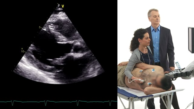 What is the best view to detect the cause of mitral regurgitation?