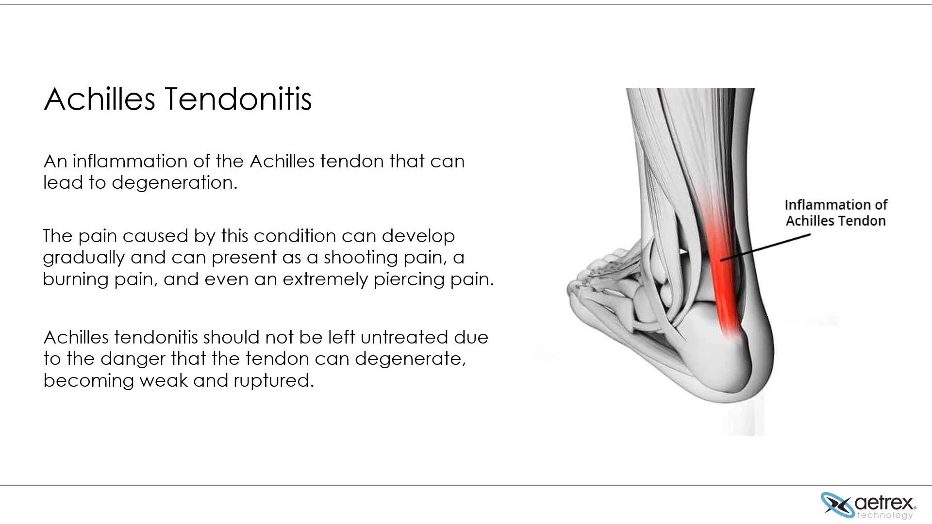 Sharp burning pain on sale in achilles tendon