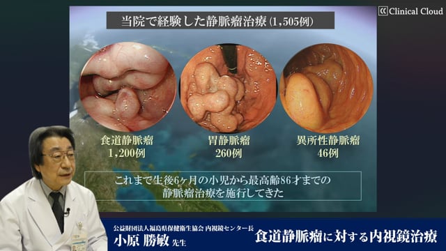 食道・胃静脈瘤 [単行本] 小原勝敏、 鈴木博昭、 村島直哉、 國分茂博 