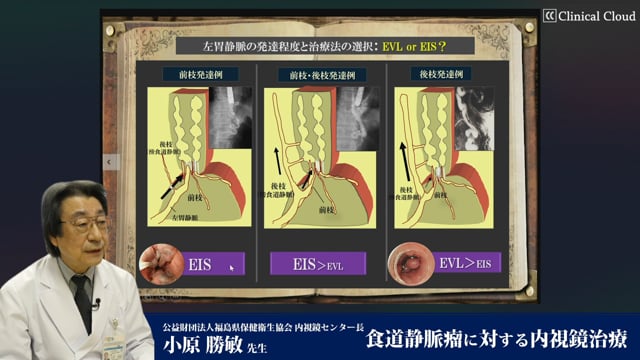 食道・胃静脈瘤 [単行本] 小原勝敏、 鈴木博昭、 村島直哉、 國分茂博 