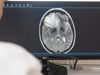Newswise: AI may help brain cancer patients avoid biopsy