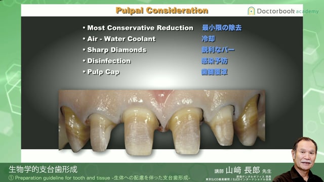 #5 Preparation guideline for tooth and tissue -生体への配慮を伴った支台歯形成-