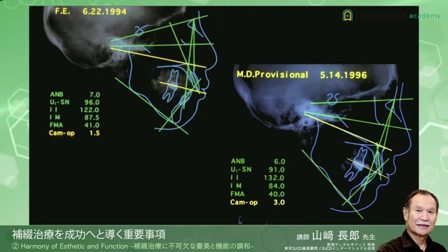 #4 Harmony of Esthetic and Function -補綴治療に不可欠な審美と機能の調和-