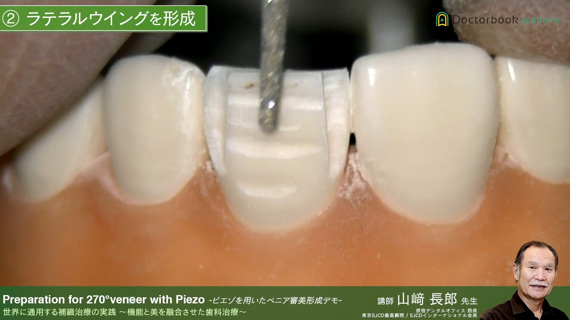 #7 Preparation for 270°veneer with Piezo -ピエゾを用いたベニア審美形成デモ-