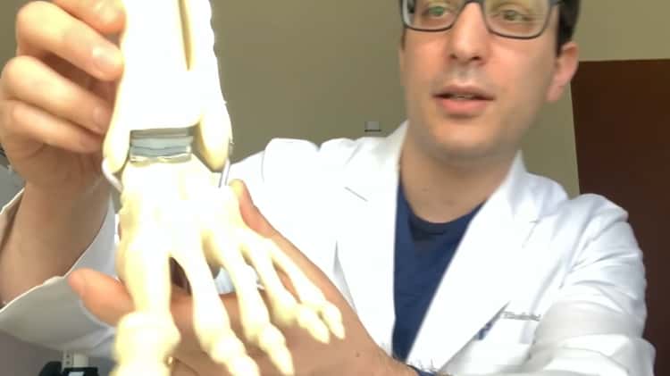 Dr. Jason Tartaglione on Total Ankle Joint Replacement on Vimeo