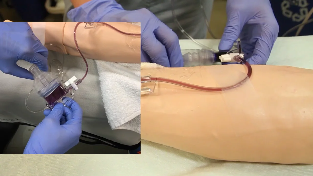 PROCEDURE/Collecting Arterial Line Blood from a VAMP on Vimeo