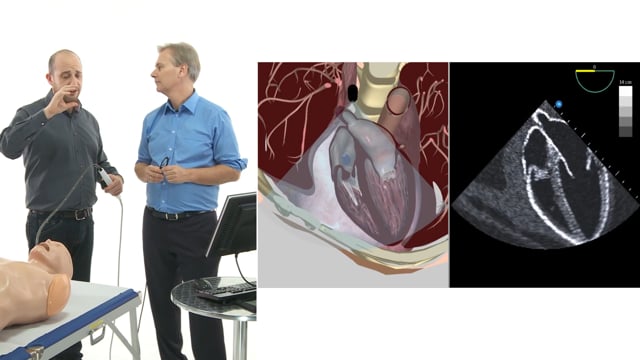 How can the right heart be visualized using TEE?