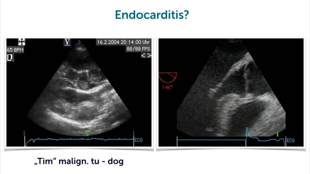 Is this really endocarditis?