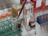 Newswise: University of Miami Treats COVID-19 Patients with MSC Stem Cells