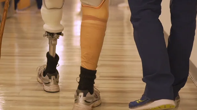 New prosthesis feels and acts like original limb