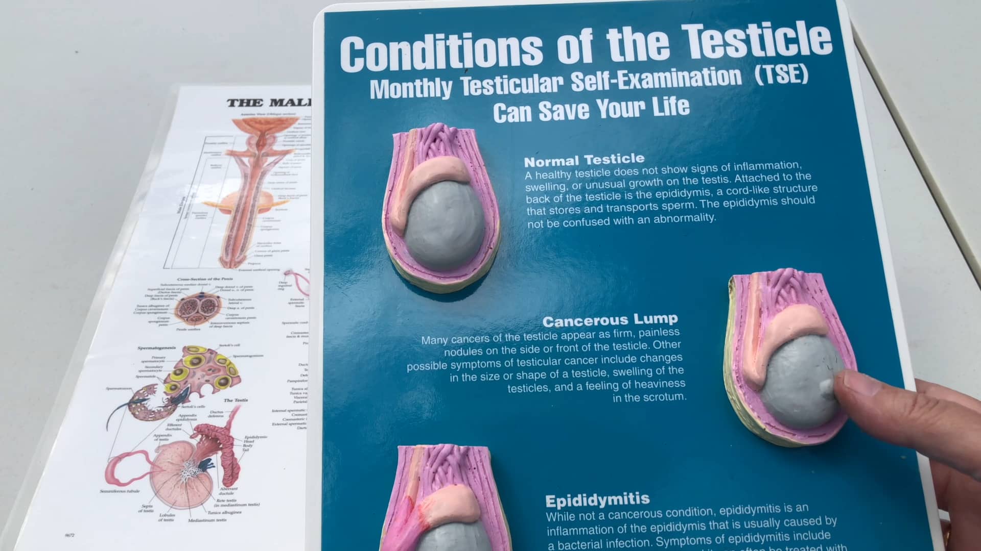 H8a2 Testicular Self Exam on Vimeo