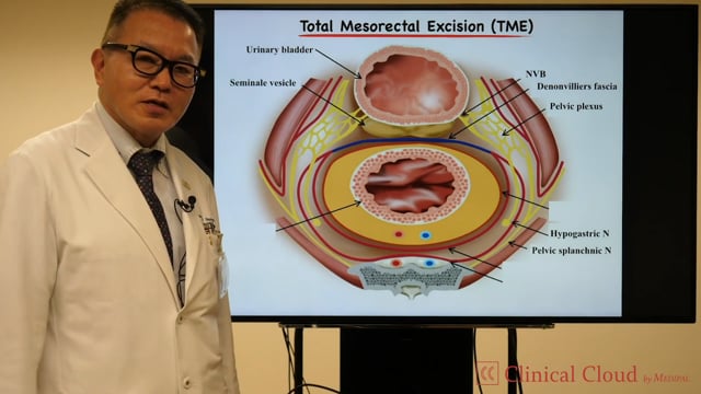 Evolution of Energy System in MIS for ColoRectal Cancer Surgery -Part1-