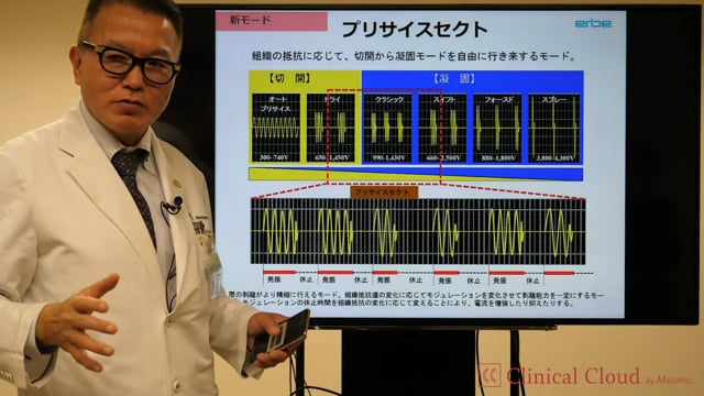 Evolution of Energy System in MIS for ColoRectal Cancer Surgery -Part3-