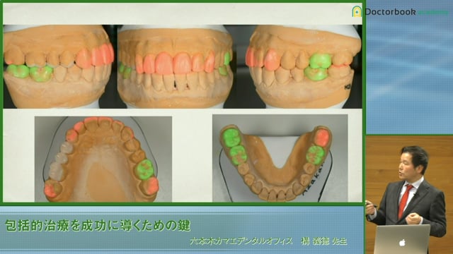 #4 矯正と補綴のゴールの違い